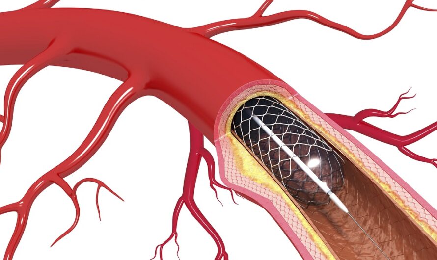 Arterial DNA damage found to be a significant factor contributing to vascular aging