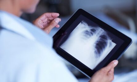 Digital Mobile X Ray Devices Market