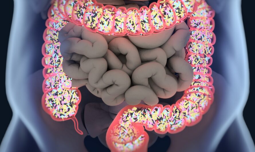 Promising Results for Experimental Drug Targeting Gut Microbiome in Long COVID Patients