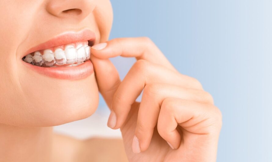 Bruxism Treatment Market is Estimated to Witness High Growth Owing to Technological Advancements in Sleep Apnea Diagnosis and Treatment Devices