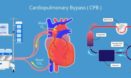 Cardiopulmonary Bypass Equipment Market