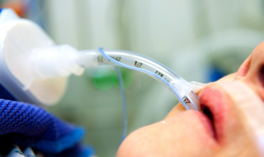 Endotracheal Tubes: An Essential Medical Device for Airway Management