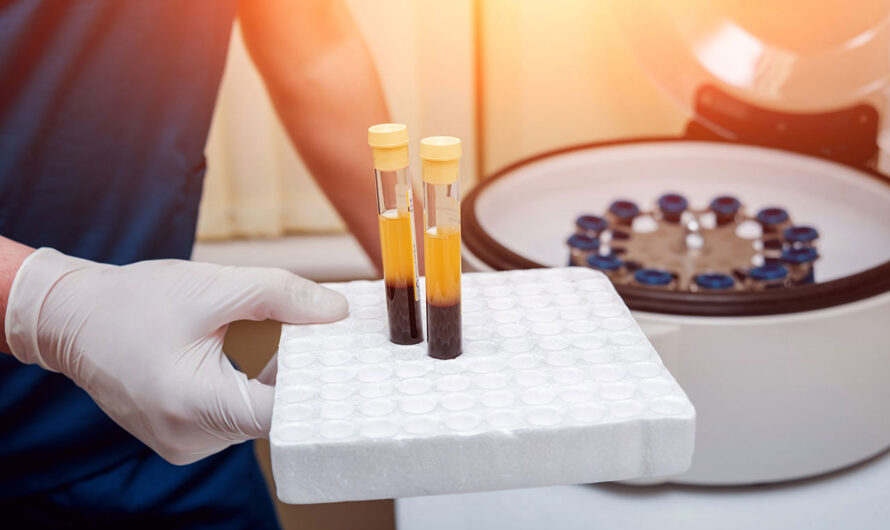 Europe Platelet Rich Plasma Market Is Set To Be Driven By Rising Cosmetic Surgery Applications