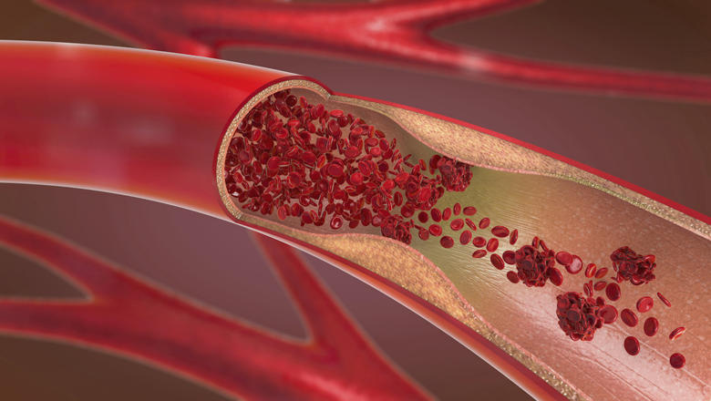 Key Molecule Sox9 Identified as a Driver of Vascular Aging