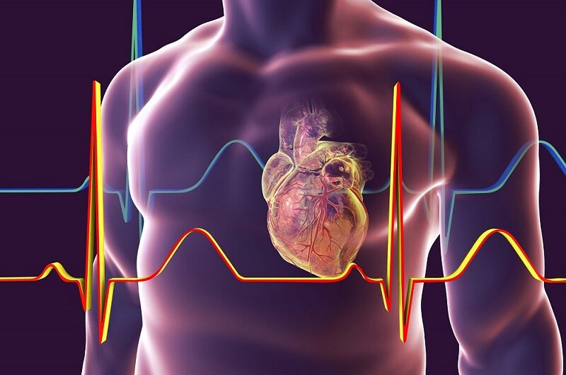 Cardiology Electrodes: Understanding the Different Types Used in Cardiac Procedures