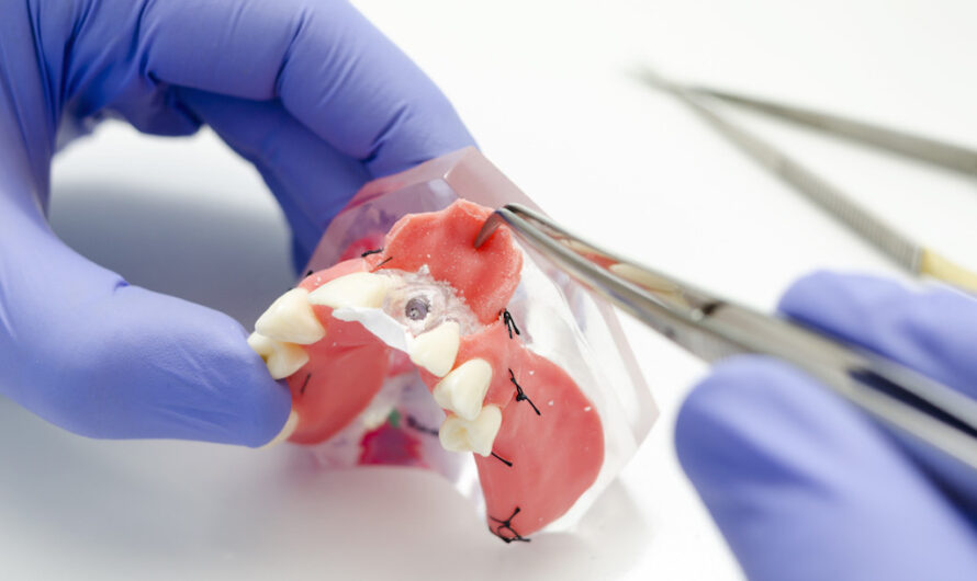 Dental Suture Market is poised to grow on Increasing Dental Implant Procedures