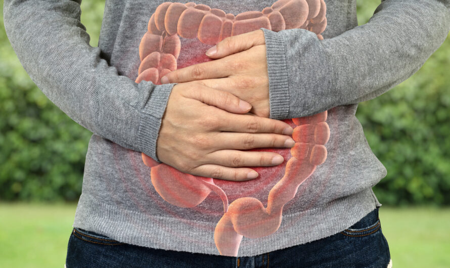 Understanding Crohn’s Disease, Ulcerative Colitis, and Their Management: A Comprehensive Overview
