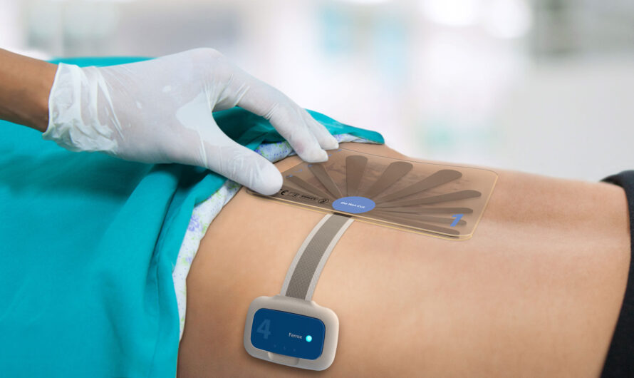 Negative Pressure Wound Therapy (NPWT) Devices Market Set To Witness High Growth Due To Advancement In Portable NPWT Systems