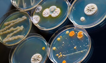 Bacterial Colony Counters Market