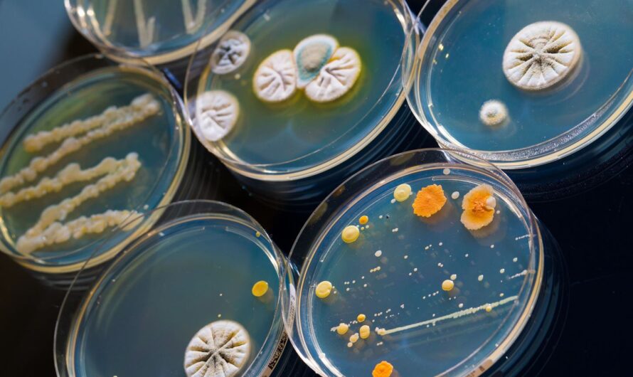 Bacterial Colony Counters Market Is Advancing Amidst Rising Microbial Testing Trends By Automation